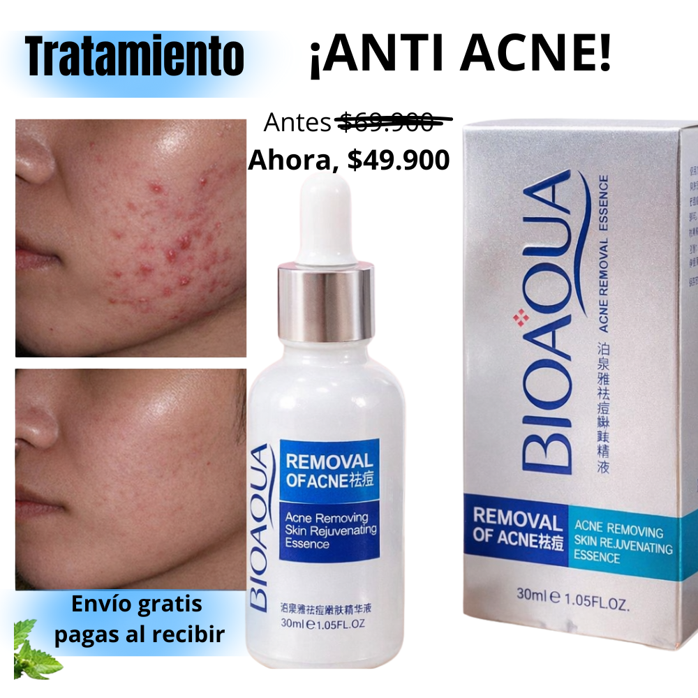 Serum Anti Acne Bioaqua